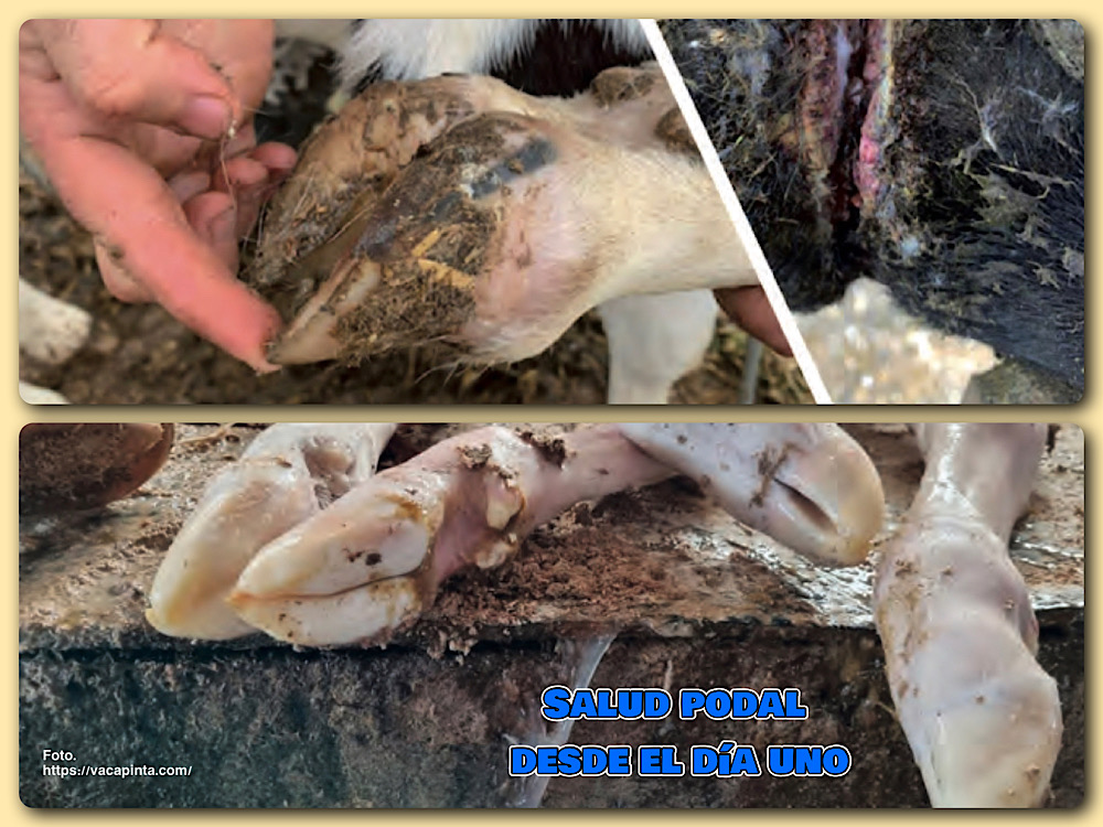 SALUD PODAL DESDE EL DÍA&nbsp;UNO